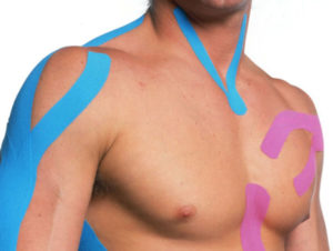 Taping neuromuscolare