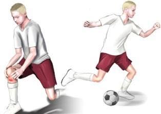 MORBO DI OSGOOD-SCHLATTER